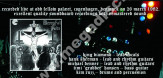 MERCYFUL FATE - Live In Copenhagen 1982 - FRA Verne Limited Press - POSŁUCHAJ - VERY RARE